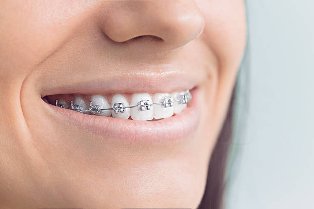 Best Dental Implants  in Farmington, IL